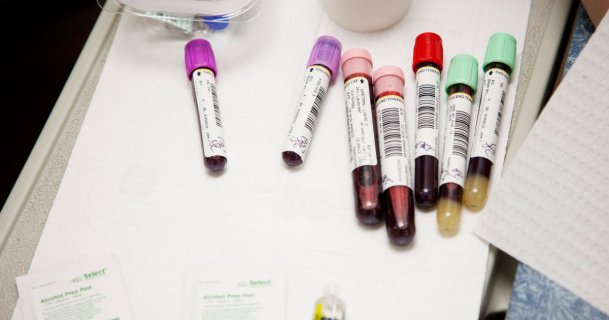 The Problem with Precision